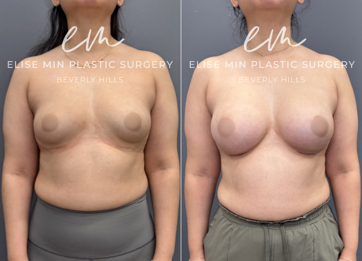 BRAUG ESRD285 Ergonomix Motiva front BRAUG ESRD285 Ergonomix Motiva front